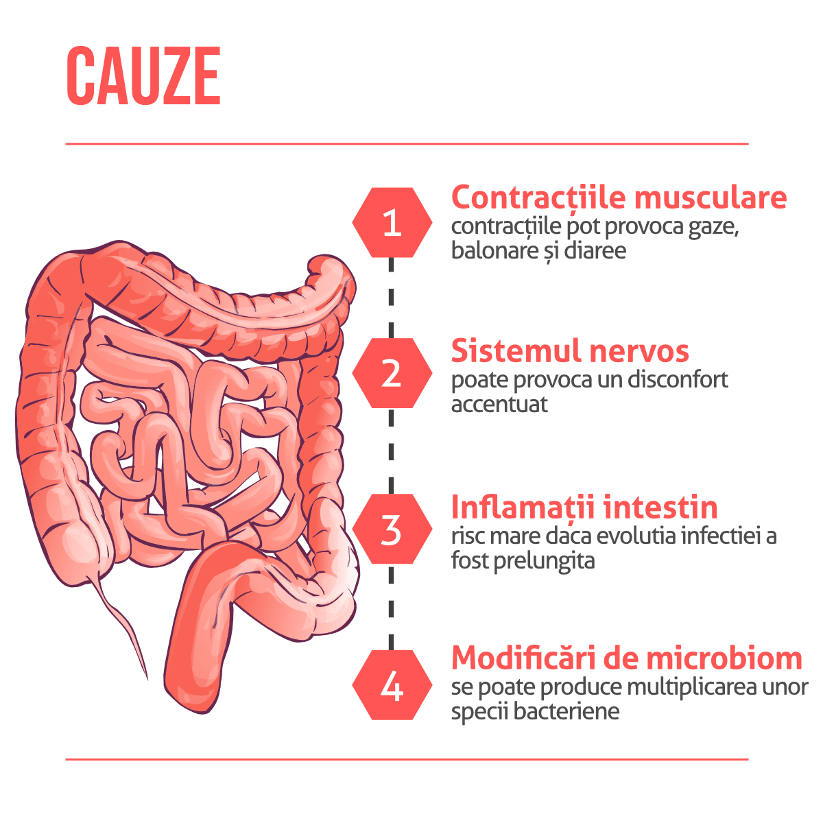 Colon iritabil