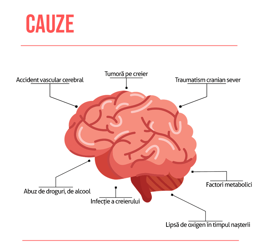 Epilepsie