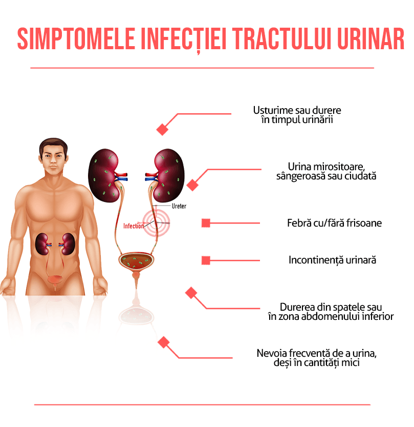 Infecția urinară