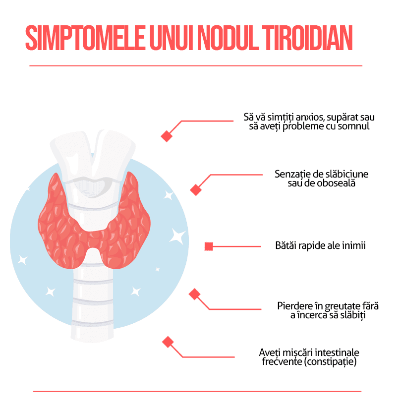 Noduli Tiroidieni
